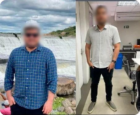 Resultado de antes e depois 3